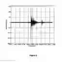 Fig. 03 - Method and instrumentation for detection of rail defects, in particular rail top defects