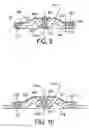 Fig. 09 - Seal assembly