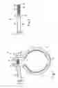 Fig. 02 - Tension clamp