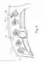 Fig. 04 - Methods absorbing energy using plastically deformable coil energy absorber