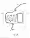 Fig. 07 - Methods absorbing energy using plastically deformable coil energy absorber