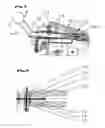 Fig. 02 - Medical appliance