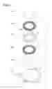 Fig. 02 - RESOLVER
