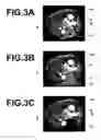 Fig. 04 - Image processing apparatus, method and program