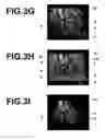 Fig. 06 - Image processing apparatus, method and program