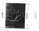 Fig. 07 - CYTOLOGICAL METHODS FOR DETECTING A CONDITION SUCH AS TRANSPLANT EFFICIENCY BY RAMAN SPECTROSCOPIC IMAGING