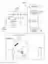 Fig. 02 - Digital subtraction angiography (DSA) motion compensated imaging system