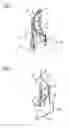 Fig. 02 - ASSEMBLED COMPONENT AND METHOD FOR PRODUCING AN ASSEMBLED COMPONENT