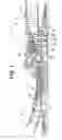 Fig. 02 - Passive cooling system for a turbomachine