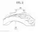 Fig. 03 - Mechanical seal