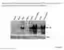 Fig. 30 - MODULATION OF IMMUNOSTIMULATORY PROPERTIES OF OLIGONUCLEOTIDE-BASED COMPOUNDS BY UTILIZING MODIFIED IMMUNOSTIMULATORY DINUCLEOTIDES