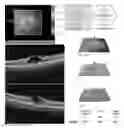 Fig. 01 - Compositions and methods for treating macular edema