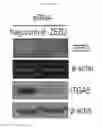 Fig. 02 - Method for screening anticancer agent or SIP1/ZEB2 inhibitor using integrin alpha 5
