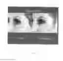 Fig. 04 - Transdermal delivery system for therapeutics
