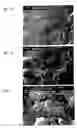 Fig. 08 - Drug Delivery Systems and Use Thereof