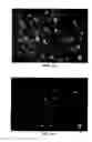 Fig. 07 - Liposomes comprising a calcium phosphate-containing precipitate