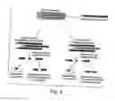 Fig. 04 - Biologic replacement for fibrin clot