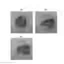 Fig. 03 - Composition for inducing tissue regeneration by activating platelet-rich plasma (PRP)