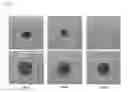 Fig. 04 - Composition for inducing tissue regeneration by activating platelet-rich plasma (PRP)