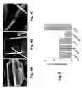 Fig. 09 - ZEOLITE COMPOSITIONS AND METHODS FOR TAILORING ZEOLITE CRYSTAL HABITS WITH GROWTH MODIFIERS