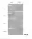 Fig. 05 - Solvent annealing block copolymers on patterned substrates