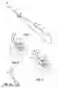 Fig. 02 - VIBRATING DENTAL INSTRUMENTS