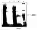 Fig. 02 - PHARMACEUTICAL COMPOSITIONS AND METHODS USEFUL FOR MODULATING ANGIOGENESIS, INHIBITING METASTASIS AND TUMOR FIBROSIS, AND ASSESSING THE MALIGNANCY OF COLON CANCER TUMORS