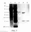 Fig. 08 - Producing an immune response for reducing the risk of developing brucellosis