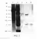 Fig. 08 - Method producing an immune response for reducing the risk of developing brucellosis