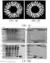 Fig. 02 - Multi-site modified SP1 polypeptides and uses thereof