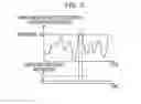Fig. 08 - Distortion compensation device, transmitter, and distortion compensation method