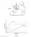 Fig. 02 - Controllable Hydraulic Turnbuckle