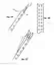 Fig. 02 - BAND DRIVE SYSTEM