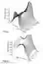Fig. 06 - Open-structure magnetic assembly for magnetic resonance imaging