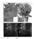 Fig. 03 - CELL LINES USEFUL FOR ASSESSING MODULATION OF AUTOPHAGY
