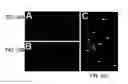 Fig. 33 - Devices and Methods for Producing and Analyzing Microarrays