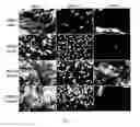 Fig. 06 - DELIVERY OF BMP-7 AND METHODS OF USE THEREOF