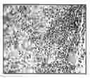Fig. 01 - COMPOSITIONS AND METHODS FOR THE TREATMENT OF CANCER