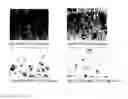 Fig. 03 - PHARMACEUTICAL COMPOSITIONS FOR THE TREATMENT/PROPHYLAXIS OF NON-ALCOHOLIC FATTY LIVER DISEASE