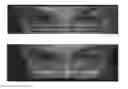 Fig. 01 - Compositions and methods for treatment of glaucoma