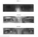 Fig. 02 - Compositions and methods for treatment of glaucoma