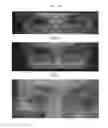 Fig. 03 - Compositions and methods for treatment of glaucoma