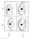 Fig. 02 - Method of enhancing hair growth