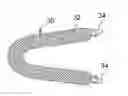 Fig. 01 - Minimally invasive implant and method