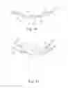 Fig. 09 - Minimally invasive implant and method