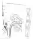 Fig. 01 - Percutaneous renal access system