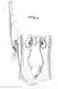 Fig. 04 - Percutaneous renal access system