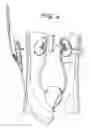 Fig. 08 - Percutaneous renal access system