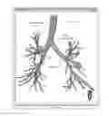 Fig. 02 - Global and semi-global registration for image-based bronchoscopy guidance