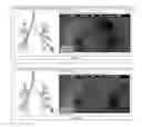 Fig. 07 - Global and semi-global registration for image-based bronchoscopy guidance